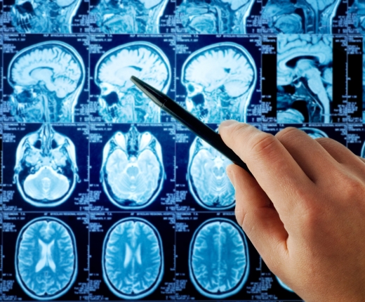 MAGNETIC RESONANCE IMAGING-UNTERSUCHUNG (MRI) MAGNETIC RESONANCE IMAGING-UNTERSUCHUNG (MRI)